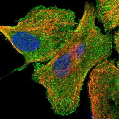 Immunocytochemistry/ Immunofluorescence: USP21 Antibody [NBP1-86871]