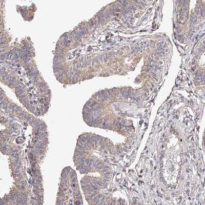 Immunohistochemistry-Paraffin: USP21 Antibody [NBP1-86871]