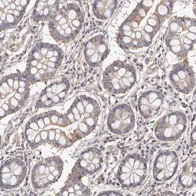 Immunohistochemistry-Paraffin: USP21 Antibody [NBP1-86871]