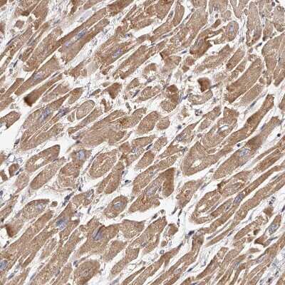 Immunohistochemistry-Paraffin: USP21 Antibody [NBP1-86871]
