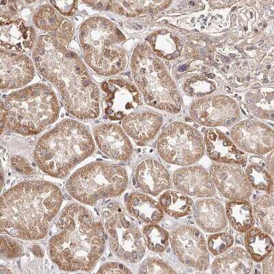 Immunohistochemistry-Paraffin: USP21 Antibody [NBP1-86871]