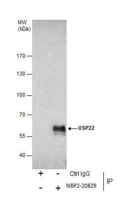 Immunoprecipitation: USP22 Antibody [NBP2-20829]