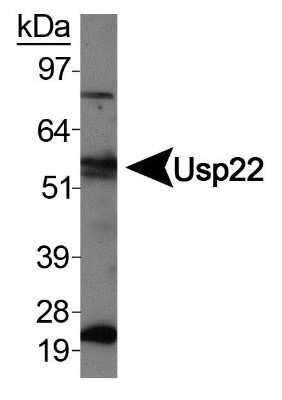 Western Blot: USP22 AntibodyBSA Free [NBP1-49644]