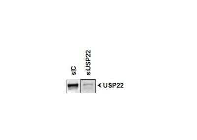 Western Blot: USP22 AntibodyBSA Free [NBP1-49644]