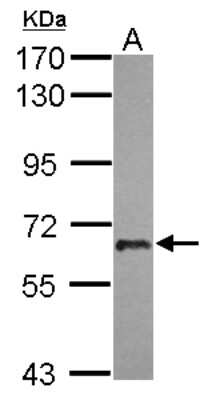 Western Blot: USP22 Antibody [NBP2-20829]