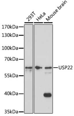 Western Blot: USP22 AntibodyAzide and BSA Free [NBP2-94320]