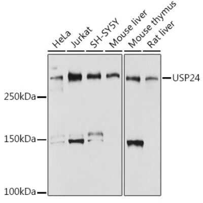 Western Blot: USP24 Antibody (7K7N2) [NBP3-15286]