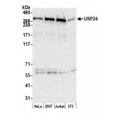 Western Blot: USP24 Antibody [NB100-40830]