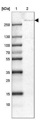 Western Blot: USP24 Antibody [NBP1-82942]