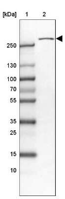 Western Blot: USP24 Antibody [NBP1-82943]