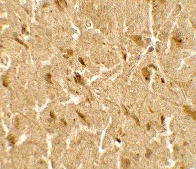 Immunohistochemistry: USP25 Antibody - BSA Free [NBP2-82051]