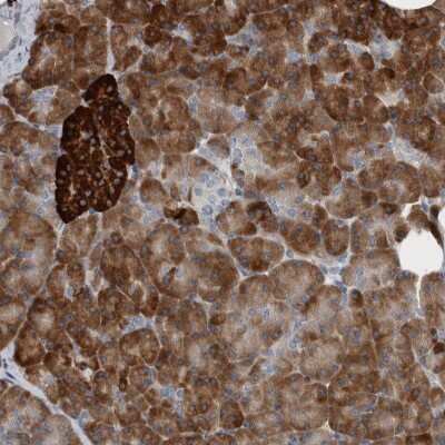 Immunohistochemistry-Paraffin: USP25 Antibody [NBP1-80630]