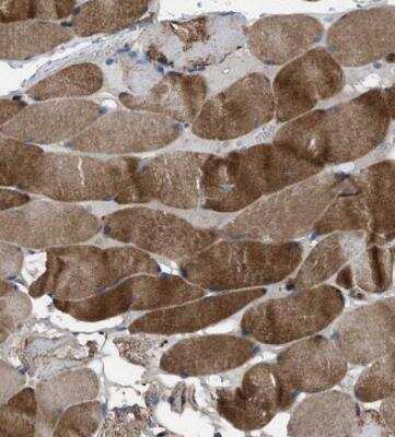Immunohistochemistry-Paraffin: USP25 Antibody [NBP1-80631]