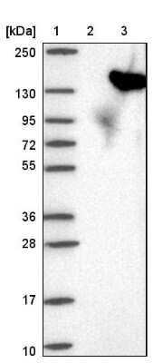 Western Blot: USP25 Antibody [NBP1-80630]