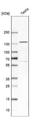 Western Blot: USP25 Antibody [NBP1-80631]