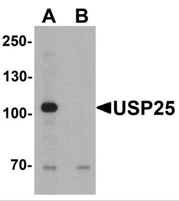 Western Blot: USP25 AntibodyBSA Free [NBP2-82051]