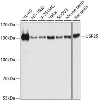 Western Blot: USP25 AntibodyBSA Free [NBP2-95136]