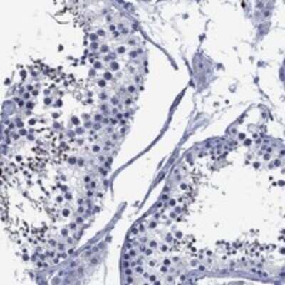 Immunohistochemistry-Paraffin: USP26 Antibody [NBP3-17324]