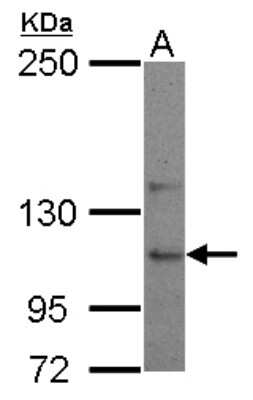 Western Blot: USP26 Antibody [NBP2-20830]