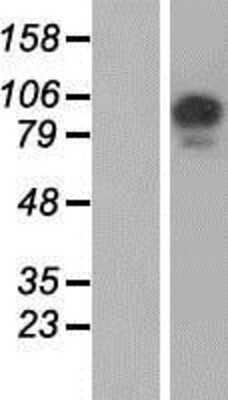 Western Blot: USP26 Overexpression Lysate [NBP2-06109]