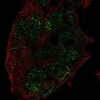 Immunocytochemistry/ Immunofluorescence: USP27X Antibody [NBP2-57733]