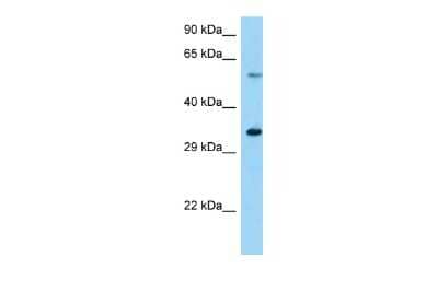 Western Blot: USP27X Antibody [NBP2-83744]