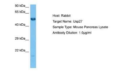 Western Blot: USP27X Antibody [NBP2-83745]