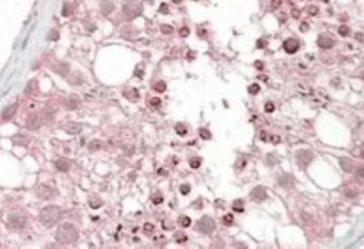 Immunohistochemistry-Paraffin: USP28 Antibody [NB100-96911]