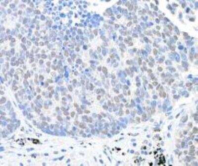 Immunohistochemistry-Paraffin: USP28 Antibody [NB110-40543]