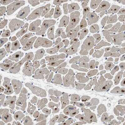 Immunohistochemistry-Paraffin: USP28 Antibody [NBP1-82904]