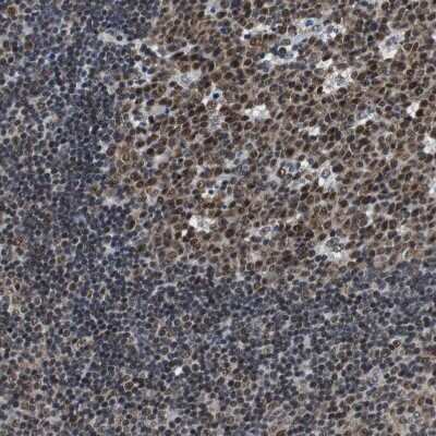 Immunohistochemistry-Paraffin: USP28 Antibody [NBP1-82904]