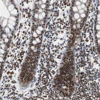 Immunohistochemistry-Paraffin: USP28 Antibody [NBP1-82904]
