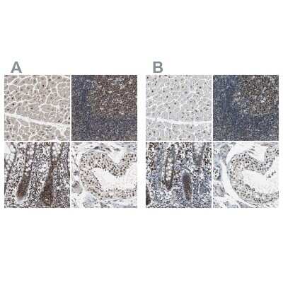 Immunohistochemistry-Paraffin: USP28 Antibody [NBP1-82904]
