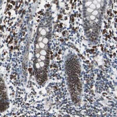 Immunohistochemistry-Paraffin: USP28 Antibody [NBP1-82905]