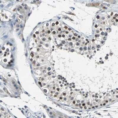 Immunohistochemistry-Paraffin: USP28 Antibody [NBP1-82905]