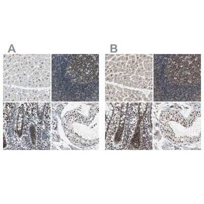 Immunohistochemistry-Paraffin: USP28 Antibody [NBP1-82905]