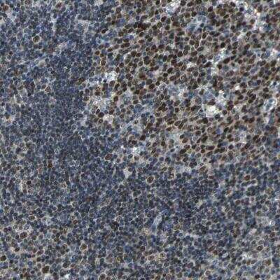 Immunohistochemistry-Paraffin: USP28 Antibody [NBP1-82905]