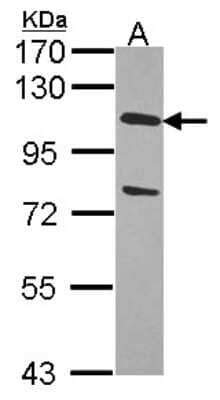 Western Blot: USP28 Antibody [NBP1-31171]