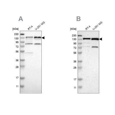 Western Blot: USP28 Antibody [NBP1-82904]