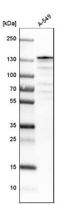 Western Blot: USP28 Antibody [NBP1-82905]