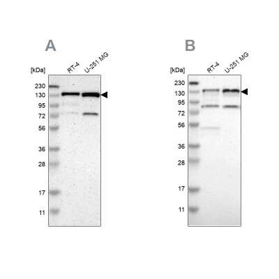 Western Blot: USP28 Antibody [NBP1-82905]