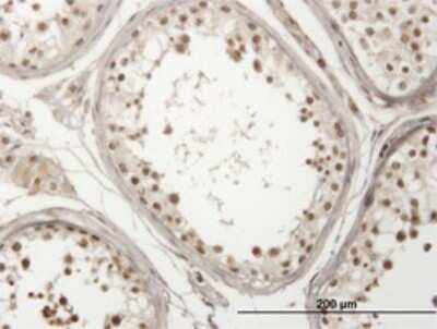 Immunohistochemistry-Paraffin: USP29 Antibody (1A8) [H00057663-M01]