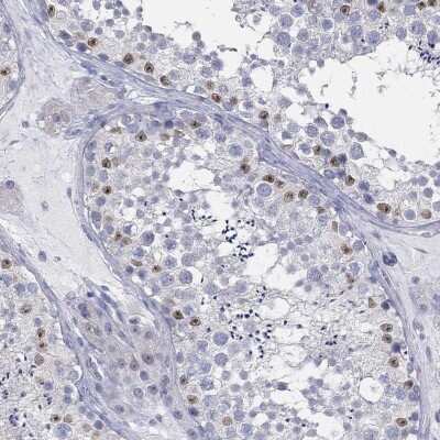 Immunohistochemistry-Paraffin: USP29 Antibody [NBP3-17070]