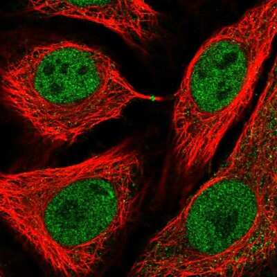 Immunocytochemistry/ Immunofluorescence: USP3 Antibody [NBP2-58394]