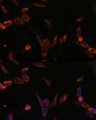 Immunocytochemistry/ Immunofluorescence: USP30 Antibody - Azide and BSA Free [NBP2-93487]