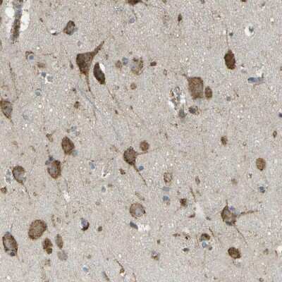 Immunohistochemistry-Paraffin: USP30 Antibody [NBP1-81914]