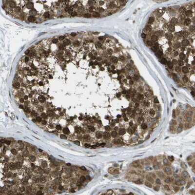 Immunohistochemistry-Paraffin: USP30 Antibody [NBP1-81914]