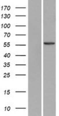 Western Blot: USP30 Overexpression Lysate [NBL1-17656]