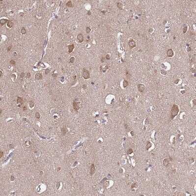 Immunohistochemistry-Paraffin: USP32 Antibody [NBP2-13509]