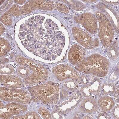Immunohistochemistry-Paraffin: USP32 Antibody [NBP2-13509]